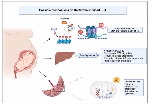 Figure 1: Possible mechanisms of small-for-gestational-age in foetus exposed to metformin