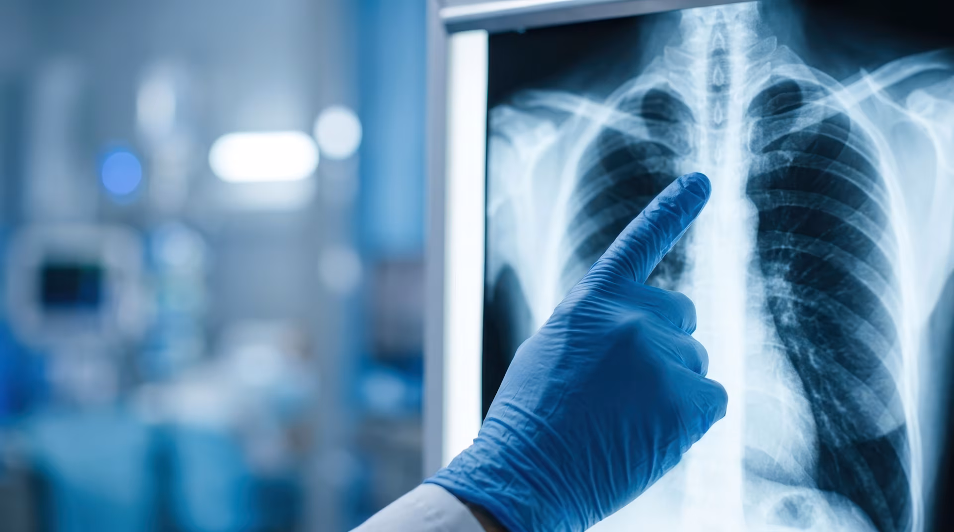 X ray scan medical chest lung radiology doctor hospital glove diagnosis Medical x ray scan radiology room doctor hand glove point chest lung monitor for diagnosis screening and healthcare