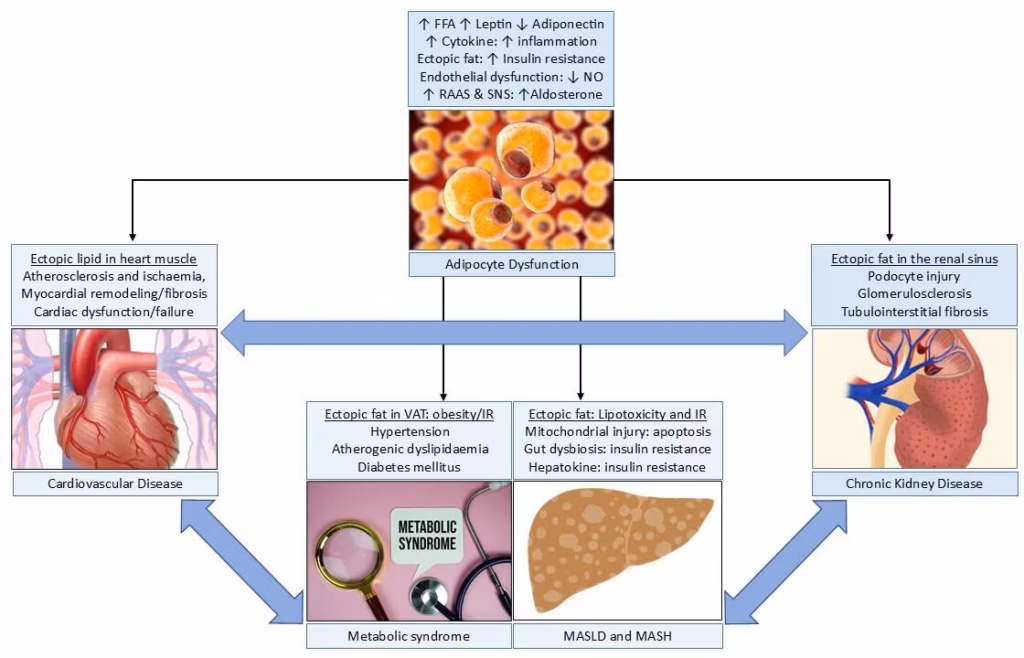 Figure 2: Pathobiological aspects of CKM syndrome